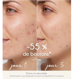 SERUM PURIFIANT ANTI-IMPERFECTIONS LA ROSEE