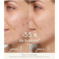 SERUM PURIFIANT ANTI-IMPERFECTIONS LA ROSEE
