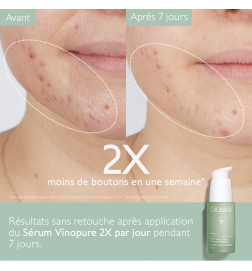 CAUDALIE VINOPURE SERUM ANTI IMP 30ML