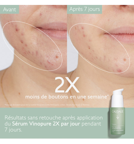CAUDALIE VINOPURE SERUM ANTI IMP 30ML