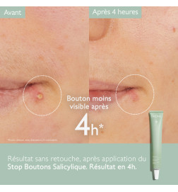 CAUDALIE VINOPURE STOP BOUTONS SALICYLIQUE 15ML