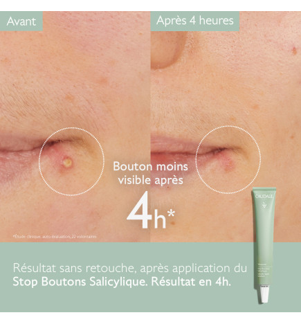CAUDALIE VINOPURE STOP BOUTONS SALICYLIQUE 15ML